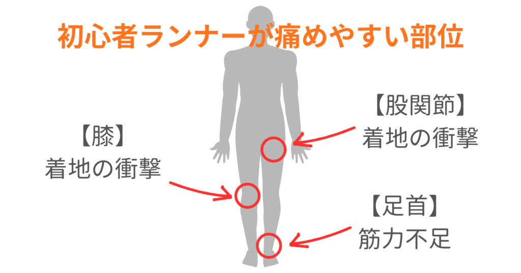 初心者ランナーが痛めやすい部位